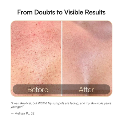 Cellergy GLOW Neck & Chest Red Light Therapy