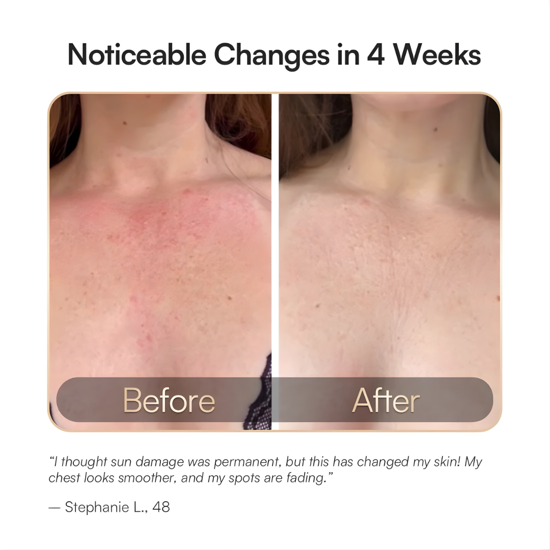 Cellergy GLOW Neck & Chest Red Light Therapy