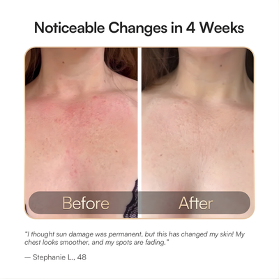 Cellergy GLOW Neck & Chest Red Light Therapy